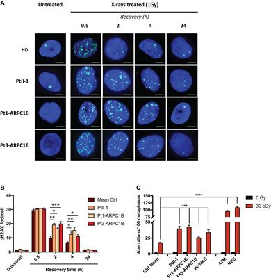 Radiosensitivity in patients affected by ARPC1B deficiency: a new disease trait?